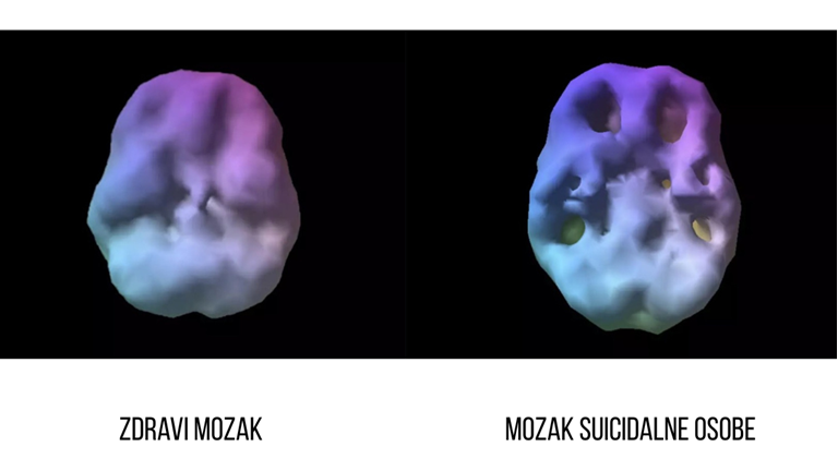 Svjetski dan prevencije suicida